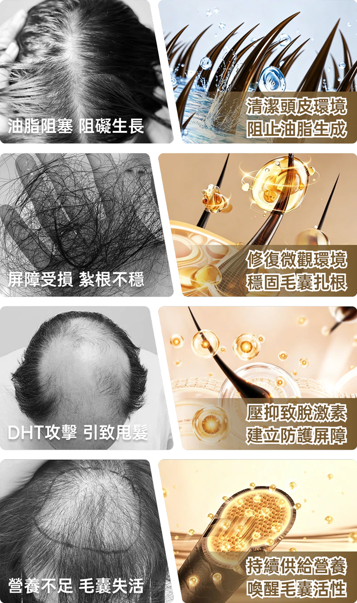 中胚層生髮技術・生髮精華直達中胚層｜解決油脂阻塞脫髮、DHT攻擊甩髮、頭皮屏障受損毛囊不穩、營養不足毛囊失活｜清潔頭皮環境抑制油脂、修復微觀環境穩固毛囊、壓抑致脫激素建立防護、持續供給營養喚醒毛囊活性